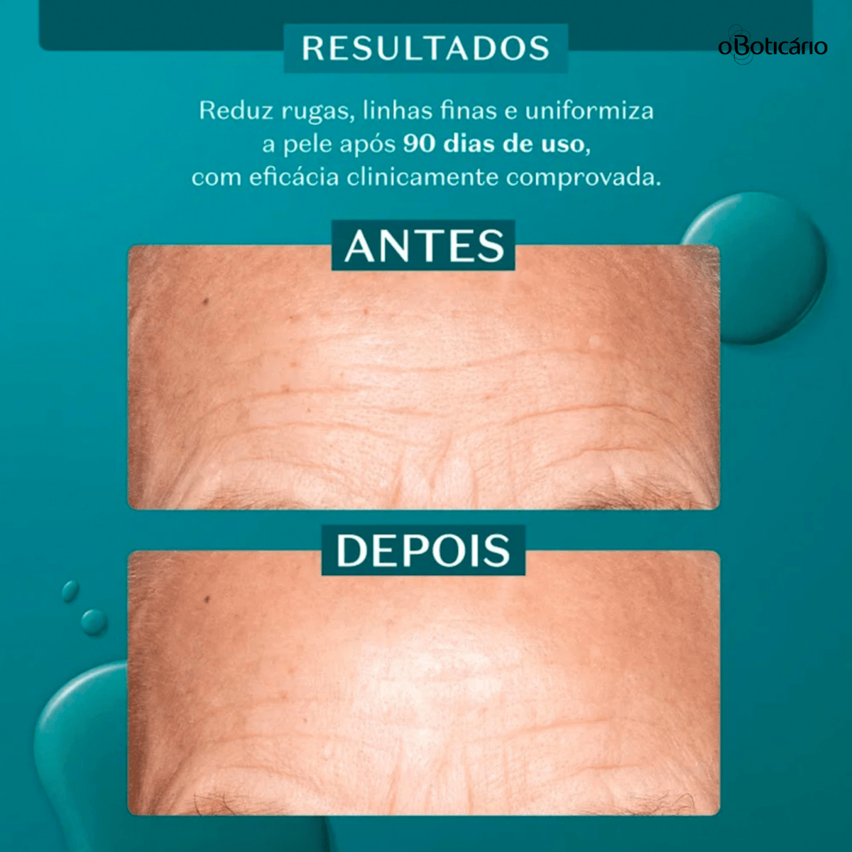 Oboticario Serum Botik Serum Alta Potencia Ácido Glicólico 8%